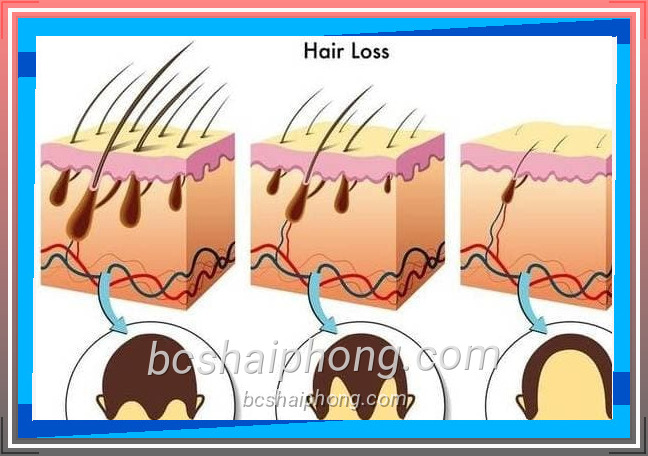 Lông vùng kín là gì và tại sao lại cứng, xoăn?