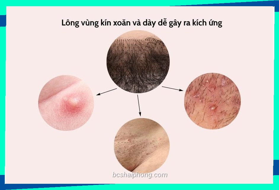 Ảnh về long vung kin anh huong suc khoe neu qua xoan va day